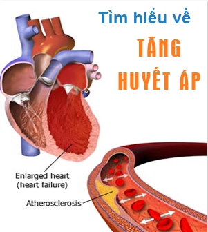 ca´c-huo´ng-da~n-mo´i-nha´t-ve`-tang-huye´t-a´p